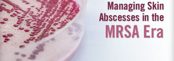 Managing Skin Abscesses In The MRSA Era Physician S Weekly