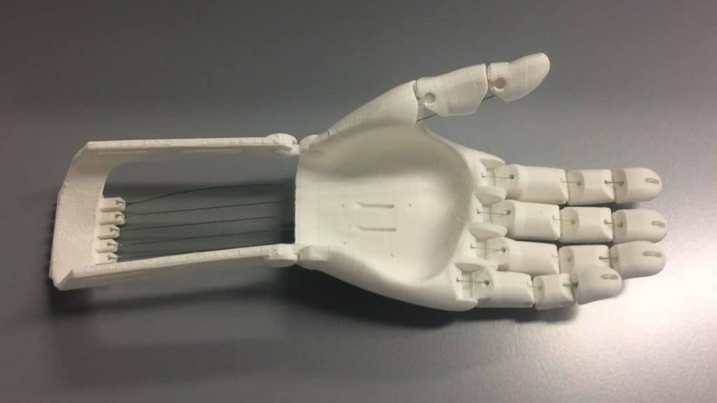 Bringing 3D Printed Prosthetic Hands To Third World Countries