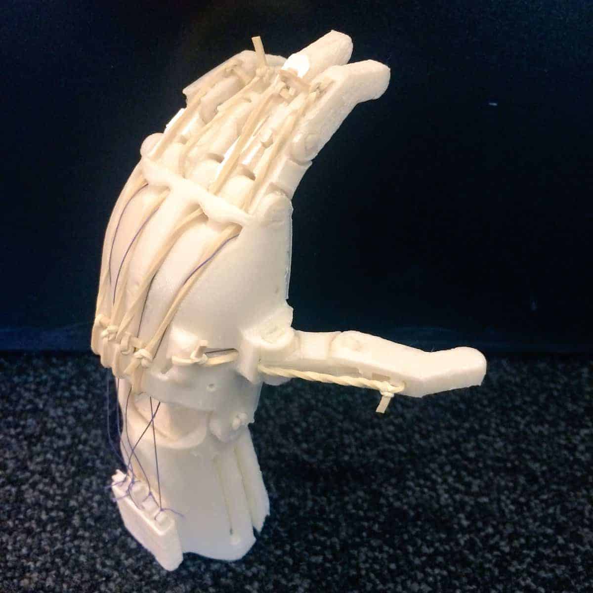 Bringing 3D-Printed Prosthetic Hands to Third-World Countries ...