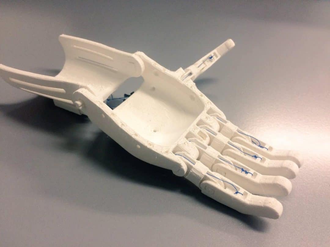 Bringing 3D-Printed Prosthetic Hands to Third-World Countries ...