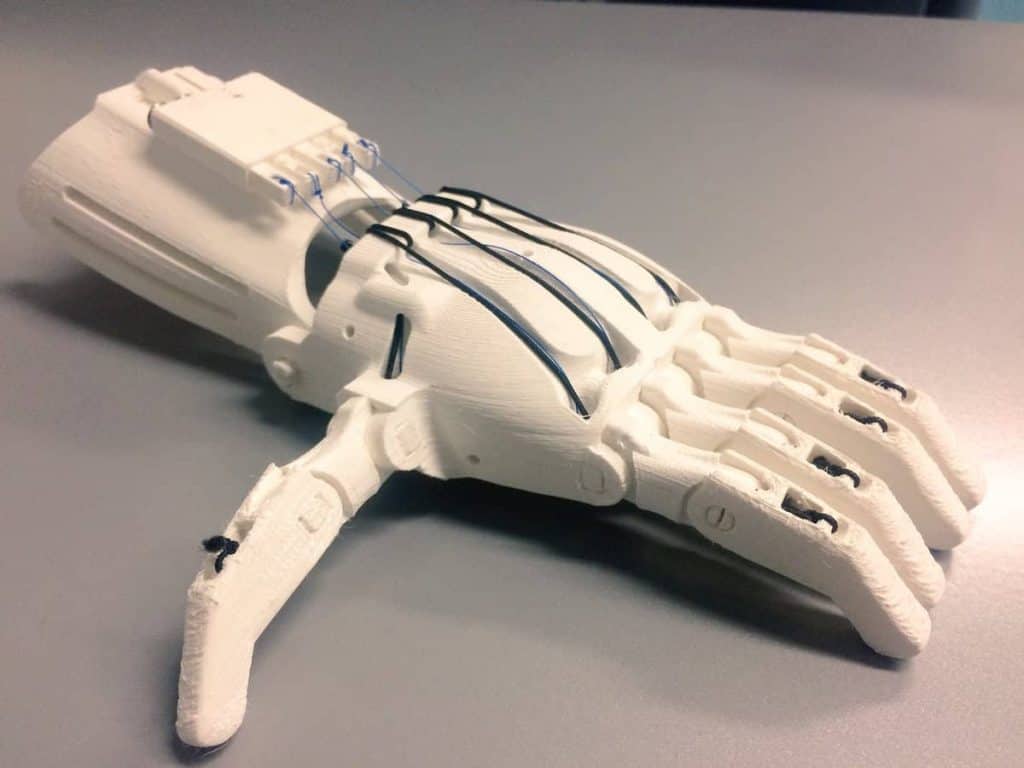 Bringing 3d-printed Prosthetic Hands To Third-world Countries 